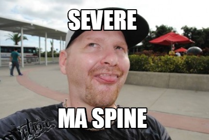 severe-ma-spine