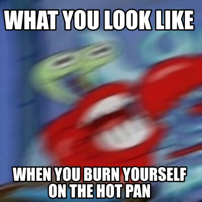 Meme Creator - Funny What You Look Like When You Burn Yourself On The 